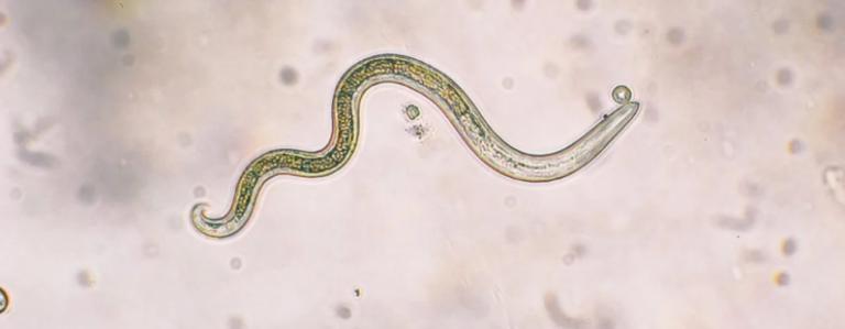 What We Don't Know About Parasites in Our Changing World Could Be Deadly
